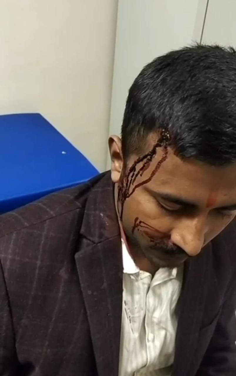 न्यायिक प्रक्रिया में बाधा का प्रयास! ख़तरे में न्याय! गवाहों को पिता की तरह मार डालने की खुली धमकी सोनभद्र में युवक पर जानलेवा हमला